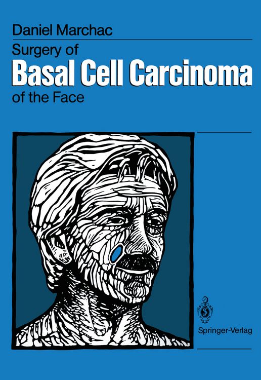 Produktbild: Surgery of Basal Cell Carcinoma of the Face