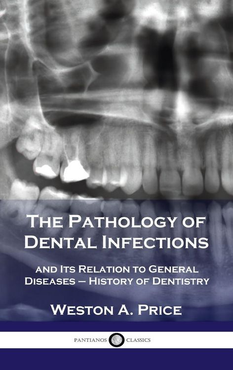 Produktbild: Pathology of Dental Infections