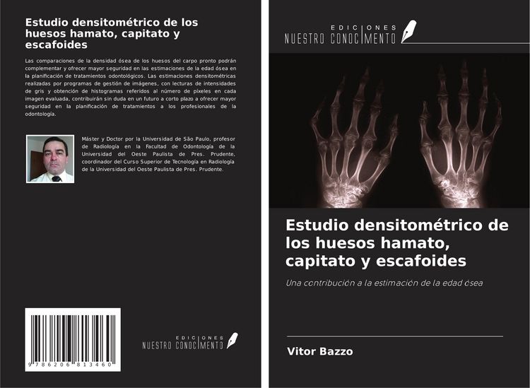 Produktbild: Estudio densitom&eacute;trico de los huesos hamato, capitato y escafoides
