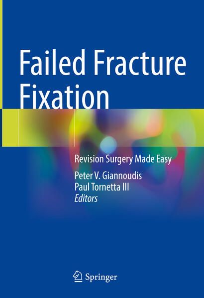 Produktbild: Failed Fracture Fixation