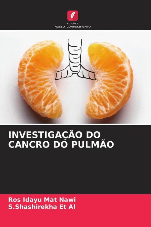 Produktbild: Investiga&ccedil;&atilde;o Do Cancro Do Pulm&atilde;o