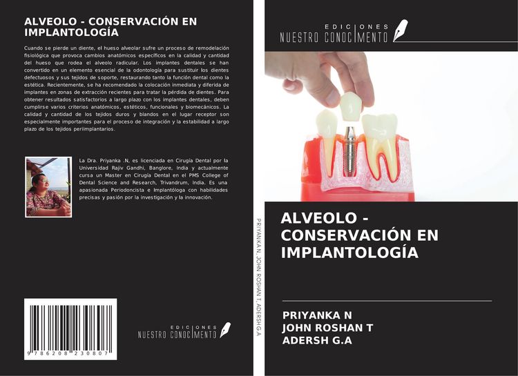 Produktbild: Alveolo - Conservaci&oacute;n En Implantolog&iacute;a