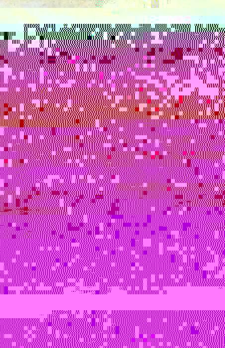Produktbild: Realist Vision