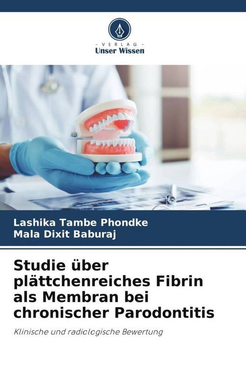 Produktbild: Studie &uuml;ber pl&auml;ttchenreiches Fibrin als Membran bei chronischer Parodontitis