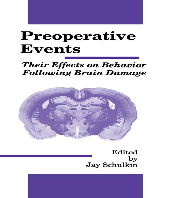 Produktbild: Preoperative Events