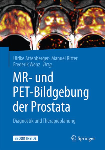 Produktbild: MR- und PET-Bildgebung der Prostata