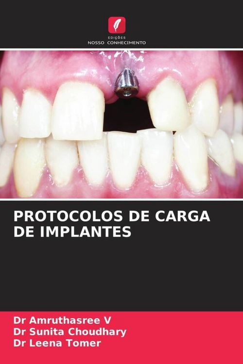 Produktbild: Protocolos De Carga De Implantes