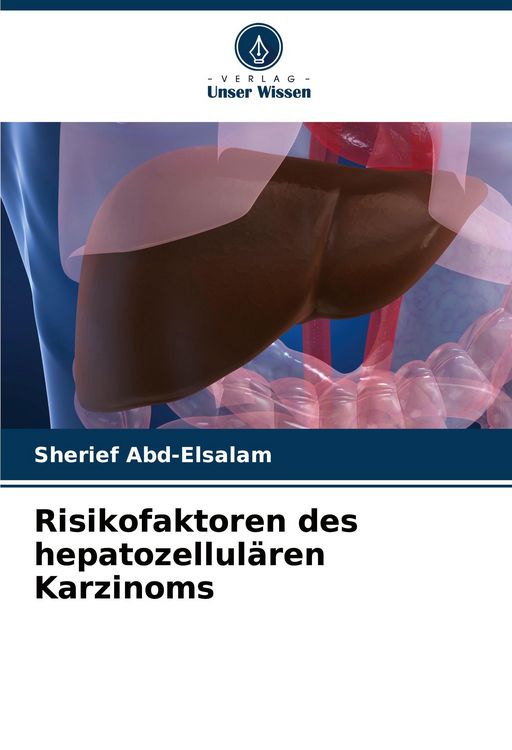 Produktbild: Risikofaktoren des hepatozellul&auml;ren Karzinoms