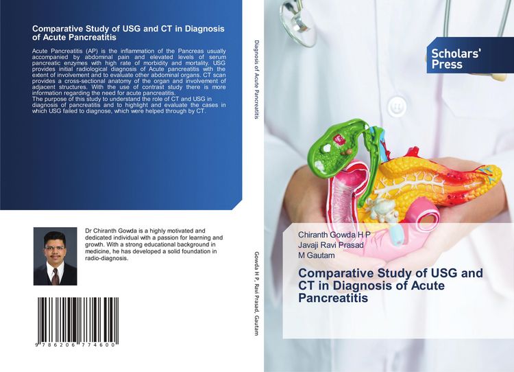 Produktbild: Comparative Study of USG and CT in Diagnosis of Acute Pancreatitis