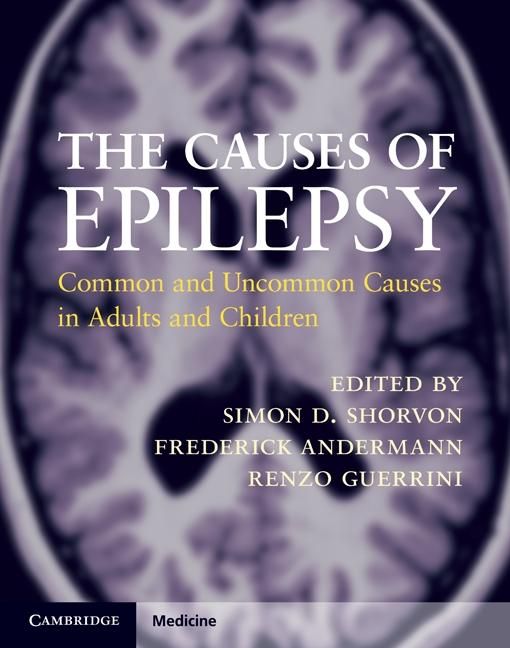 Produktbild: Causes of Epilepsy
