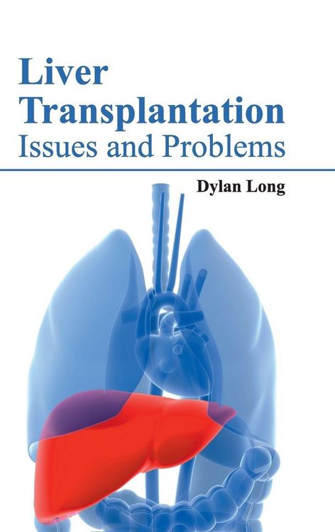 Produktbild: Liver Transplantation