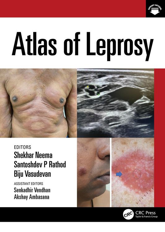 Produktbild: Atlas of Leprosy