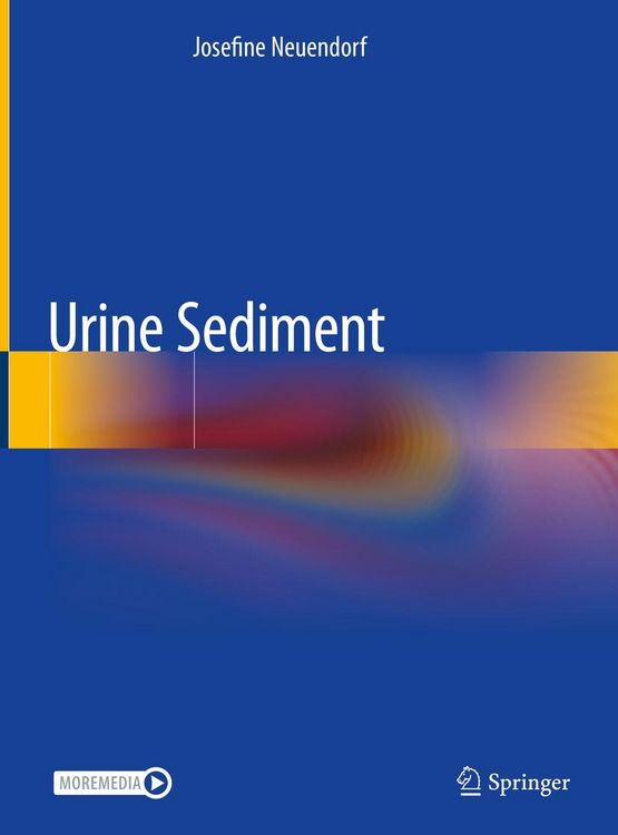 Produktbild: Urine Sediment