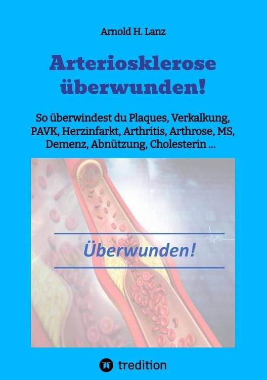 Produktbild: Arteriosklerose &uuml;berwunden!
