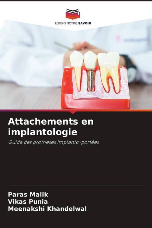 Produktbild: Attachements en implantologie