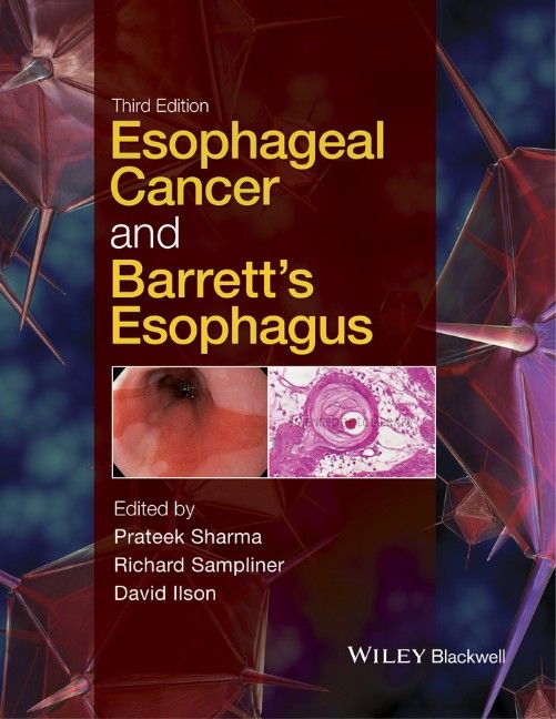 Produktbild: Esophageal Cancer and Barrett's Esophagus