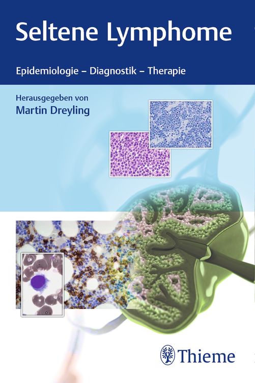 Produktbild: Seltene Lymphome
