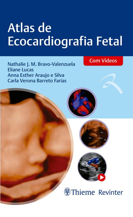 Produktbild: Atlas de Ecocardiografia Fetal