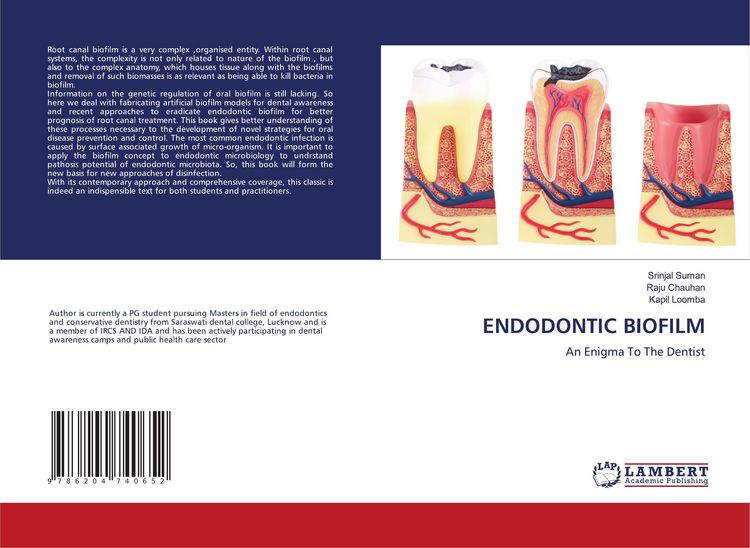 Produktbild: Endodontic Biofilm
