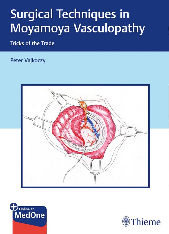 Produktbild: Surgical Techniques in Moyamoya Vasculopathy