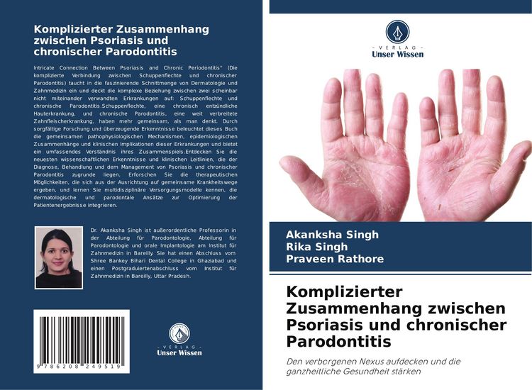 Produktbild: Komplizierter Zusammenhang zwischen Psoriasis und chronischer Parodontitis