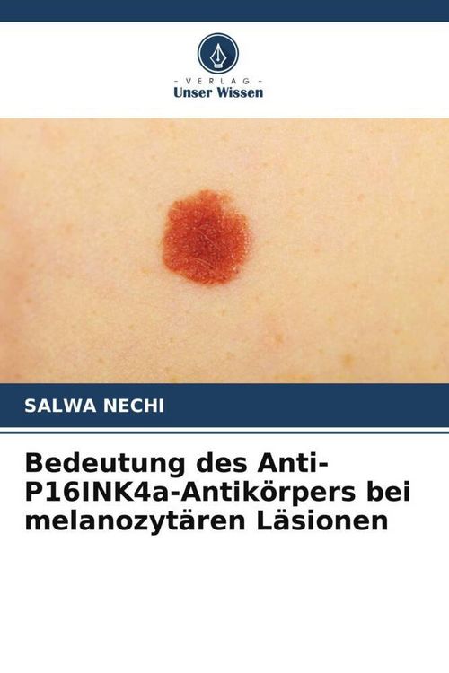 Produktbild: Bedeutung des Anti-P16INK4a-Antik&ouml;rpers bei melanozyt&auml;ren L&auml;sionen