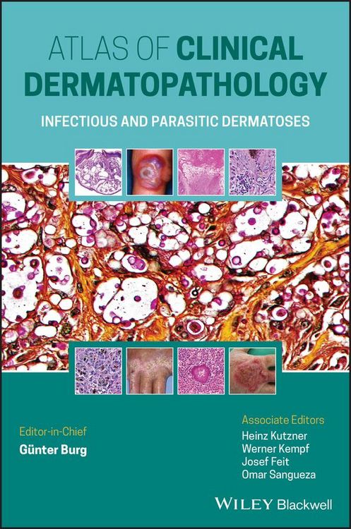 Produktbild: Atlas of Clinical Dermatopathology