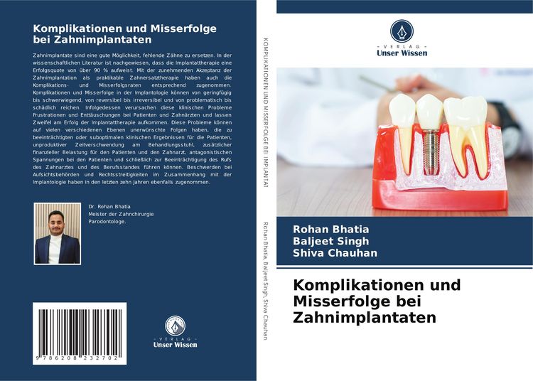 Produktbild: Komplikationen und Misserfolge bei Zahnimplantaten