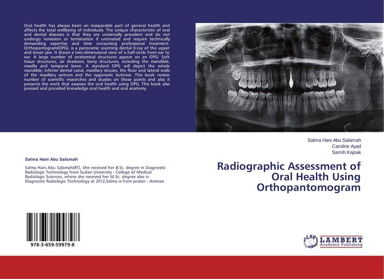 Produktbild: Radiographic Assessment of Oral Health Using Orthopantomogram