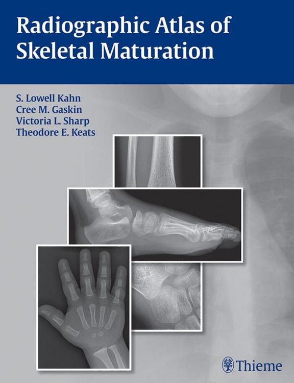 Produktbild: Radiographic Atlas of Skeletal Maturation
