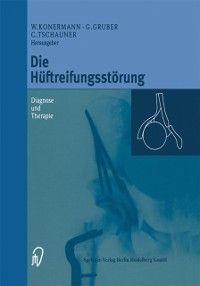 Produktbild: Die H&uuml;ftreifungsst&ouml;rung
