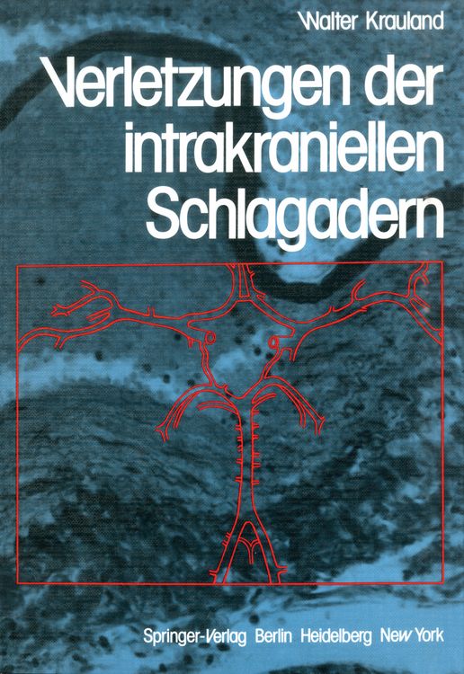 Produktbild: Verletzungen der intrakraniellen Schlagadern