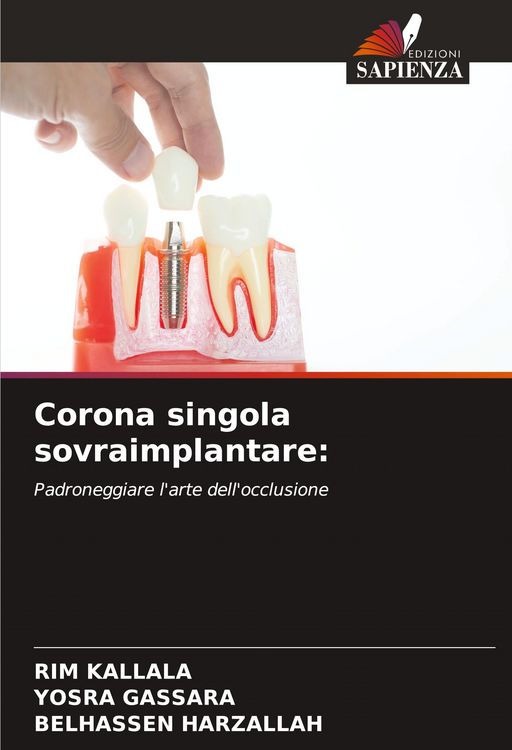 Produktbild: Corona singola sovraimplantare: