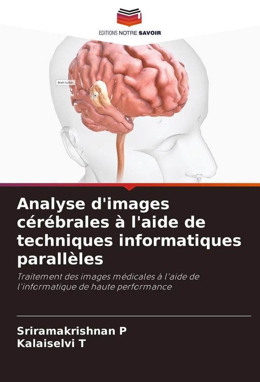 Produktbild: Analyse d'images c&eacute;r&eacute;brales &agrave; l'aide de techniques informatiques parall&egrave;les