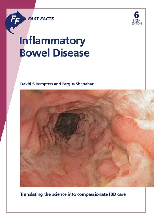 Produktbild: Fast Facts: Inflammatory Bowel Disease