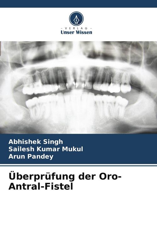 Produktbild: &Uuml;berpr&uuml;fung der Oro-Antral-Fistel