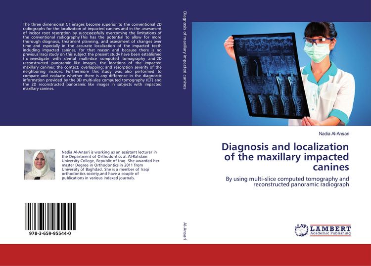 Produktbild: Diagnosis and localization of the maxillary impacted canines