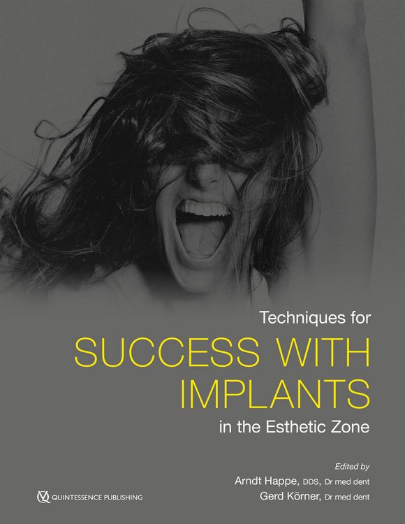 Produktbild: Techniques for Success With Implants in the Esthetic Zone