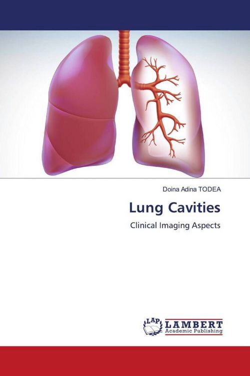 Produktbild: Lung Cavities
