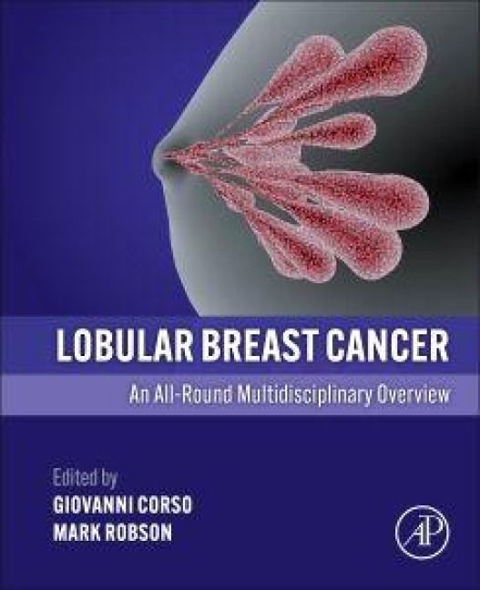 Produktbild: Lobular Breast Cancer