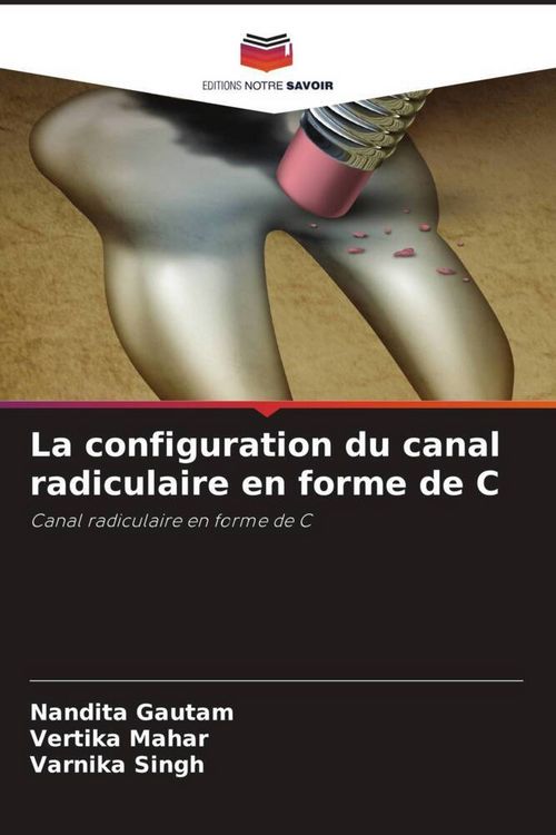 Produktbild: La configuration du canal radiculaire en forme de C