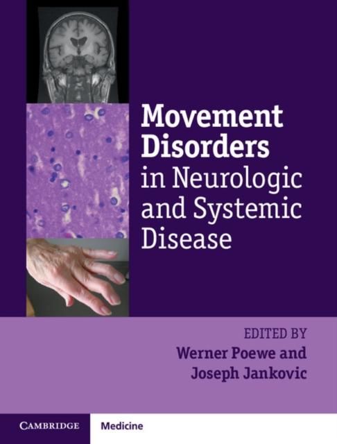 Produktbild: Movement Disorders in Neurologic and Systemic Disease