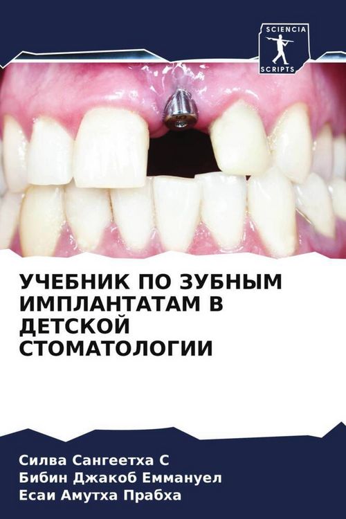 Produktbild: Uchebnik Po Zubnym Implantatam V Detskoj Stomatologii