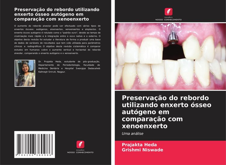 Produktbild: Preserva&ccedil;&atilde;o do rebordo utilizando enxerto &oacute;sseo aut&oacute;geno em compara&ccedil;&atilde;o com xenoenxerto