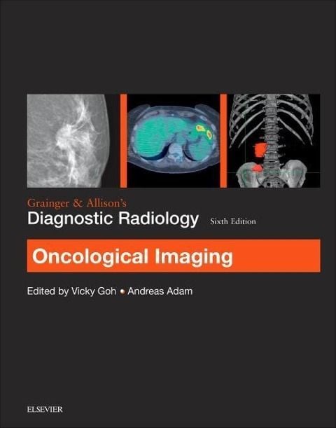Produktbild: Grainger & Allison's Diagnostic Radiology: Oncological Imaging