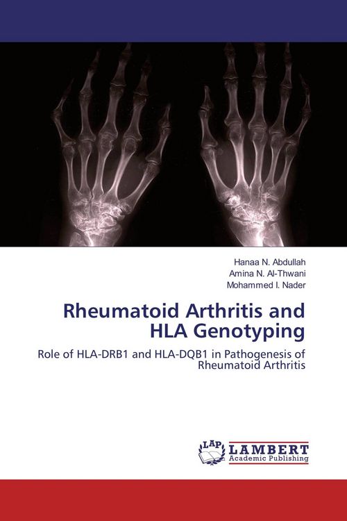 Produktbild: Rheumatoid Arthritis and HLA Genotyping