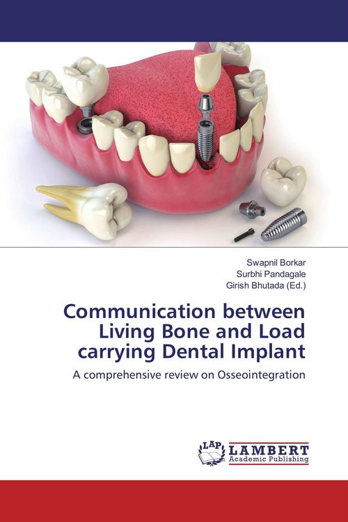 Produktbild: Communication between Living Bone and Load carrying Dental Implant