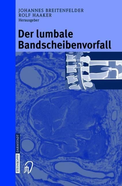 Produktbild: Der lumbale Bandscheibenvorfall