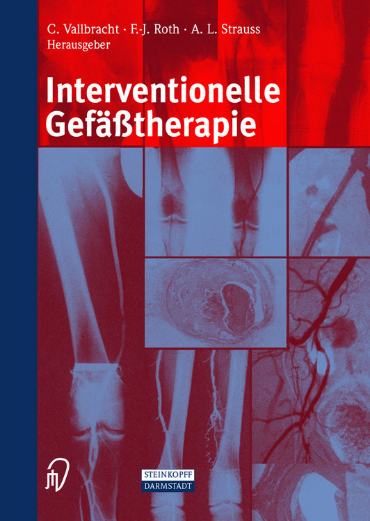 Produktbild: Interventionelle Gef&auml;&szlig;therapie
