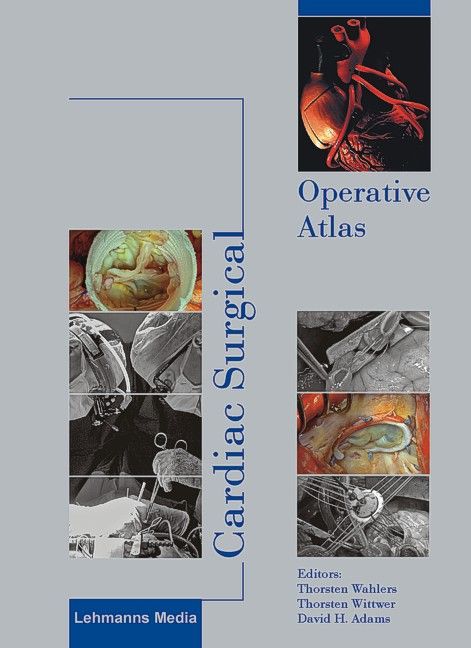 Produktbild: Cardiac Surgical Operative Atlas